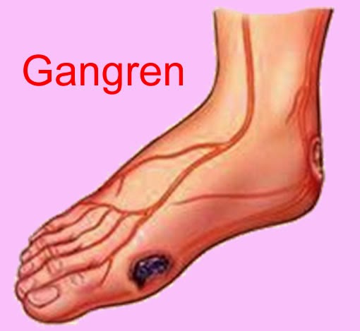 gangren