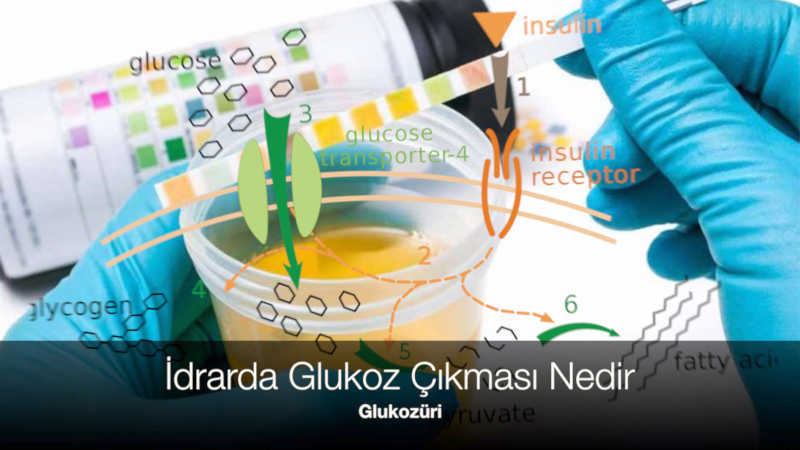 glukozuri nedir idrarda seker tahlili