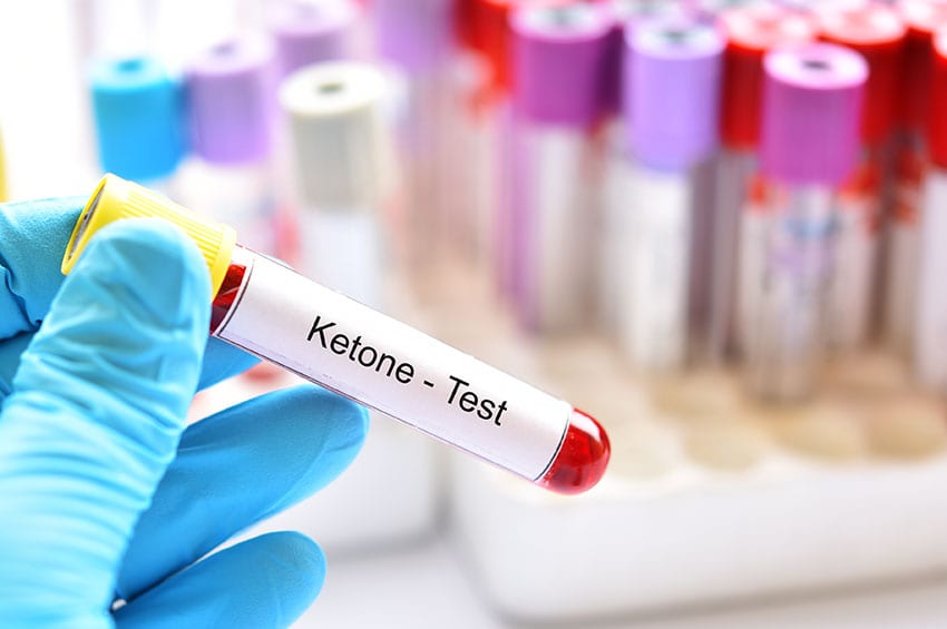 ketoacidosis ketone test