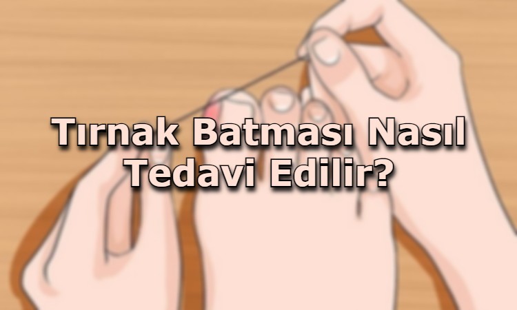 nasil tedavi edilir tirnak batmasi