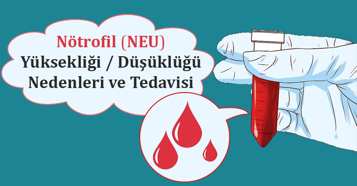 notrofil neu yuksekligi nedenleri ve tedavisi h34503 00c39